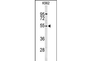 Western blot analysis of RPS6KB2 Antibody (ABIN652424 and ABIN2842096) in K562 cell line lysates (35 μg/lane). (RPS6KB2 Antikörper)