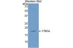 Western blot analysis of recombinant Human TTR.