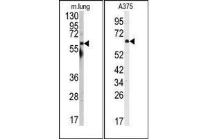 Image no. 1 for anti-Nuclear Receptor Coactivator 1 (NCOA1) (N-Term) antibody (ABIN359992) (NCOA1 Antikörper  (N-Term))