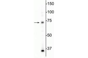 Western blot of mouse whole brain lysate showing specific immunolabeling of the MeCP2 protein at ~75 kDa. (MECP2 Antikörper)