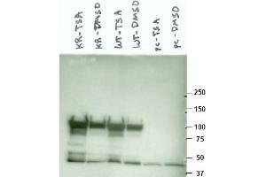 Image no. 1 for anti-Heat Shock Protein 90kDa alpha (Cytosolic), Class A Member 1 (HSP90AA1) (AA 289-300) antibody (ABIN401342) (HSP90AA1 Antikörper  (AA 289-300))