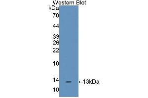 Western blot analysis of the recombinant protein. (IL17F Antikörper  (AA 31-163))