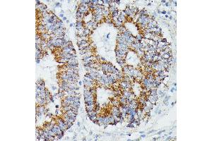 Immunohistochemistry (IHC) image for anti-Isovaleryl-CoA Dehydrogenase (IVD) (AA 33-200) antibody (ABIN7268031)