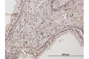 Immunoperoxidase of purified MaxPab antibody to RNF111 on formalin-fixed paraffin-embedded human prostate.