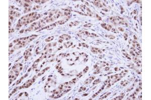 IHC-P Image Immunohistochemical analysis of paraffin-embedded A549 xenograft, using XPA, antibody at 1:500 dilution.