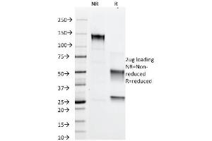 SDS-PAGE Analysis Purified Adipophilin Mouse Monoclonal Antibody (ADFP/1366). (ADRP Antikörper  (AA 249-376))