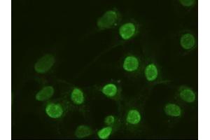 Anti-ACTN1 mouse monoclonal antibody (ABIN2452359) immunofluorescent staining of HeLa cells transiently transfected by pCMV6-ENTRY ACTN1 (RC204924) (ACTN1 Antikörper  (AA 650-893))