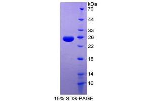 SDS-PAGE (SDS) image for TNF Like Ligand 1A (AA 67-251) protein (His tag) (ABIN2127216)