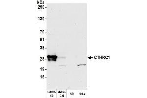 anti-Collagen Triple Helix Repeat Containing 1 (CTHRC1) (AA 25-75) antibody