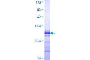 Image no. 1 for Tumor Necrosis Factor Receptor Superfamily, Member 11a, NFKB Activator (TNFRSF11A) (AA 31-130) protein (GST tag) (ABIN1323152) (TNFRSF11A Protein (AA 31-130) (GST tag))