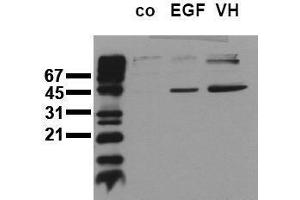 Western Blotting (WB) image for anti-Mitogen-Activated Protein Kinase Kinase 1 (MAP2K1) (pSer218), (pSer222), (pSer226) antibody (ABIN126836) (MEK1 Antikörper  (pSer218, pSer222, pSer226))