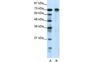 WB Suggested Anti-HIC1 Antibody Titration:  0. (HIC1 Antikörper  (N-Term))