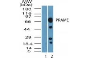 Image no. 1 for anti-Preferentially Expressed Antigen in Melanoma (PRAME) (AA 460-510) antibody (ABIN232167) (PRAME Antikörper  (AA 460-510))