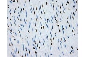 Image no. 20 for anti-Replication Protein A2, 32kDa (RPA2) antibody (ABIN1500733)