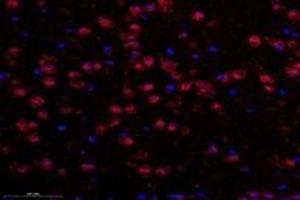 Immunofluorescent analysis of paraformaldehyde-fixed mouse substantia nigra using TBXT (ABIN7075815) at dilution of 1: 600 (T-Box 19 Antikörper)