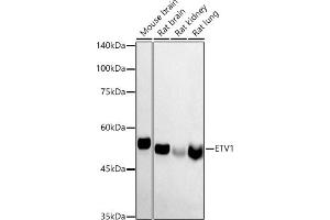 Western blot analysis of extracts of various cell lines, using ETV1 antibody (ABIN6129795, ABIN6140328, ABIN6140330 and ABIN6223003) at 1:1000 dilution. (ETV1 Antikörper  (AA 1-200))