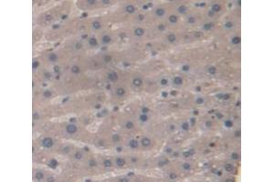 Immunohistochemistry (IHC) image for anti-serpin Peptidase Inhibitor, Clade A (Alpha-1 Antiproteinase, Antitrypsin), Member 6 (SERPINA6) (AA 106-255) antibody (ABIN1858273)