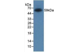 Detection of Recombinant Protein RPK170Hu01 with GST-tag using Anti-Glutathione S Transferase (GST) Tag Monoclonal Antibody (GST Antikörper  (AA 1-218))