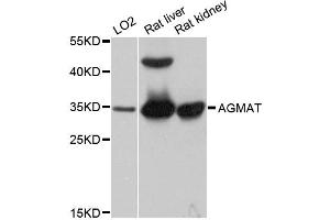 Western blot analysis of extracts of various cell lines, using AGMAT antibody. (AGMAT Antikörper)