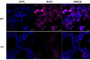 Immunocytochemical staining of HT- cells using RHOC antibody (ABIN7800143), 1:1,000), Top panel: wild-type (WT), Bottom panal: RHOC shRNA knockdown (KD). (RHOC Antikörper)