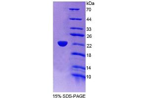 SDS-PAGE analysis of Mouse ACOX3 Protein. (ACOX3 Protein)