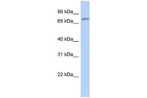 WB Suggested Anti-ZNF45 Antibody Titration:  0. (ZNF45 Antikörper  (Middle Region))