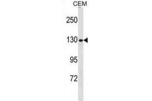 Western Blotting (WB) image for anti-Non-SMC Condensin I Complex, Subunit G (NCAPG) antibody (ABIN3000708) (NCAPG Antikörper)