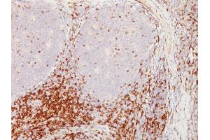 Formalin-fixed, paraffin-embedded human Tonsil stained with CD5 Mouse Monoclonal Antibody (CD5/54/F6). (CD5 Antikörper)