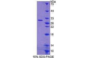 SDS-PAGE analysis of Rat CRISP1 Protein.