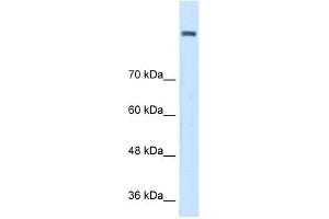 WB Suggested Anti-AOC2 Antibody Titration:  0. (AOC2 Antikörper  (Middle Region))