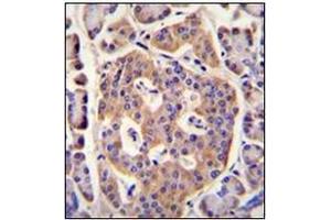 Immunohistochemistry analysis in formalin fixed and paraffin embedded human pancreas tissue reacted with PLD5 Antibody (C-term) followed which was  peroxidase conjugated to the secondary antibody and followed by DAB staining. (PLD5 Antikörper  (C-Term))