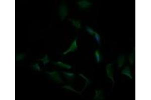 Image no. 3 for anti-Carbonic Anhydrase 12 (CA12) antibody (ABIN1497065)