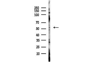 anti-Target of Myb1 (Chicken)-Like 1 (TOM1L1) antibody