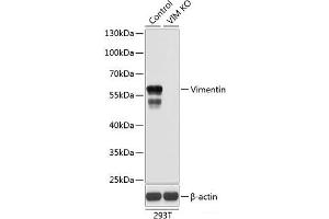 Western blot analysis of extracts from normal (control) and Vimentin knockout (KO) 293T cells using Vimentin Polyclonal Antibody at dilution of 1:1000. (Vimentin Antikörper)