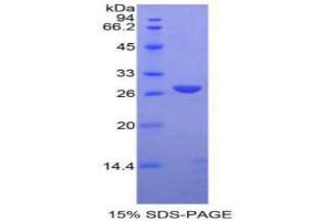 SDS-PAGE analysis of Rat ADAM10 Protein. (ADAM10 Protein)
