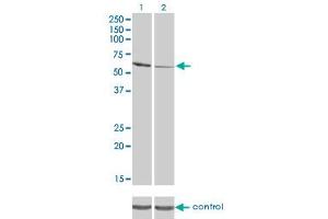 Western blot analysis of RIOK3 over-expressed 293 cell line, cotransfected with RIOK3 Validated Chimera RNAi (Lane 2) or non-transfected control (Lane 1).