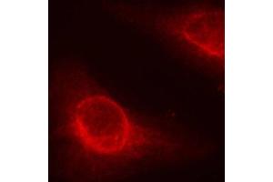 Immunofluorescence staining of methanol-fixed Hela cells, using phospho-CFL1-S3 antibody. (Cofilin Antikörper  (pSer3))
