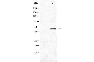 Western blot analysis of GATA1 expression in K562 whole cell lysates,The lane on the left is treated with the antigen-specific peptide. (GATA1 Antikörper  (Internal Region))
