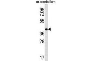 Western Blotting (WB) image for anti-Homeobox D13 (HOXD13) antibody (ABIN2998512) (Homeobox D13 Antikörper)