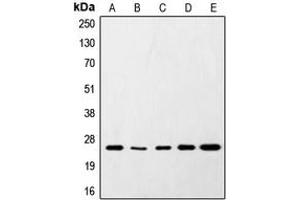 Western blot analysis of SNAP25 expression in HeLa (A), SKNSH (B), RAW264. (SNAP25 Antikörper  (C-Term))