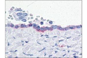 Human Ovary: Formalin-Fixed, Paraffin-Embedded (FFPE) (ENPP3 Antikörper  (Internal Region))