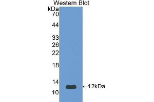 Western blot analysis of the recombinant protein. (SERPINA12 Antikörper  (AA 52-143))