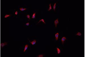 ABIN6266496 staining HepG2  cells by IF/ICC.
