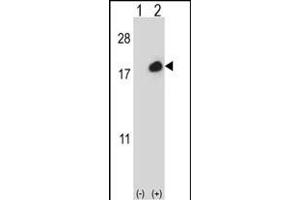 Western blot analysis of ISG15 (arrow) using rabbit polyclonal ISG15 Antibody (C-term ) (ABIN387984 and ABIN2844985). (ISG15 Antikörper  (C-Term))