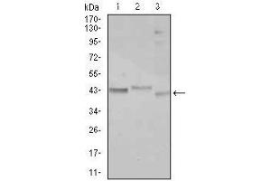 Western blot analysis using CEBPA mouse mAb against Jurkat (1), k562 (2), and HepG2 (3) cell lysate. (CEBPA Antikörper)