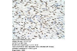 Rabbit Anti-HNRPAB Antibody  Paraffin Embedded Tissue: Human Heart Cellular Data: Myocardial cells Antibody Concentration: 4. (HNRNPAB Antikörper  (C-Term))