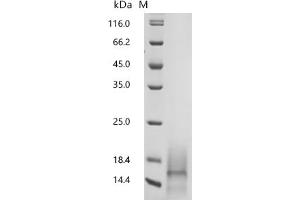 Gastric Inhibitory Polypeptide (GIP) (AA 22-85) protein (His tag)