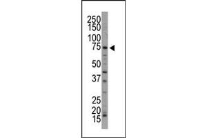 Western Blotting (WB) image for anti-NUAK Family, SNF1-Like Kinase, 1 (NUAK1) (C-Term) antibody (ABIN360528) (NUAK1 Antikörper  (C-Term))