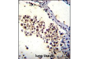 DOK3 Antibody (C-term) (ABIN655979 and ABIN2845363) immunohistochemistry analysis in formalin fixed and paraffin embedded human lung tissue followed by peroxidase conjugation of the secondary antibody and DAB staining. (DOK3 Antikörper  (C-Term))
