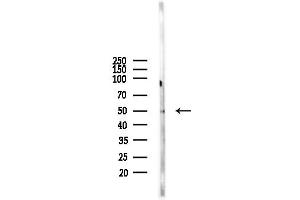 anti-Tripartite Motif Containing 38 (TRIM38) (Internal Region) antibody